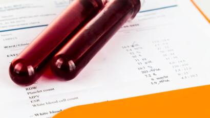 Analisi del sangue e sport