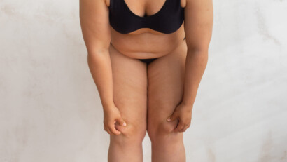 Grasso localizzato: come eliminare una silhouette che odi