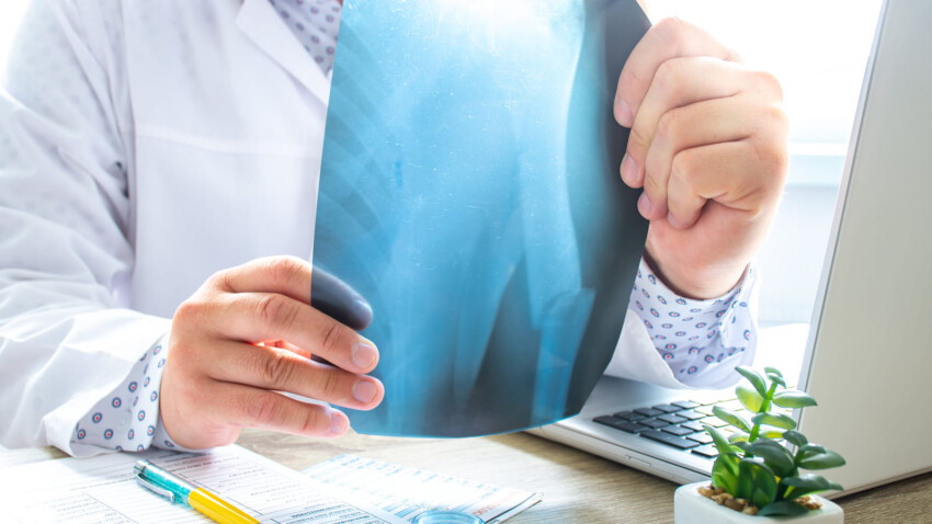 I falsi miti riguardo l impingement sub acromiale