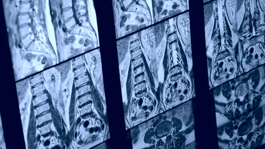 La rmn non e affidabile