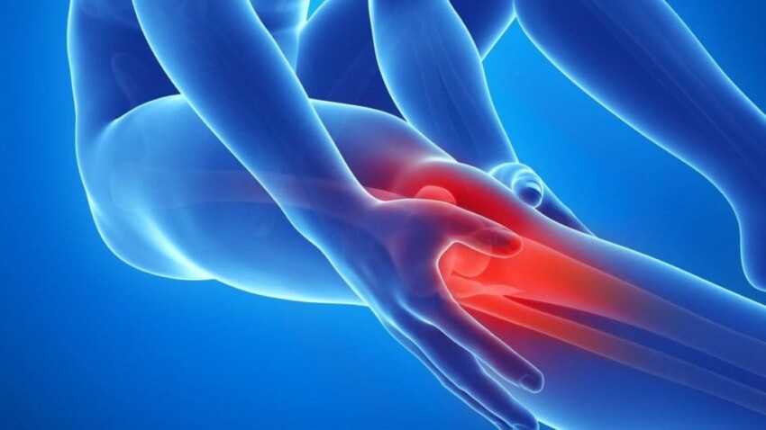 La sindrome patello femorale