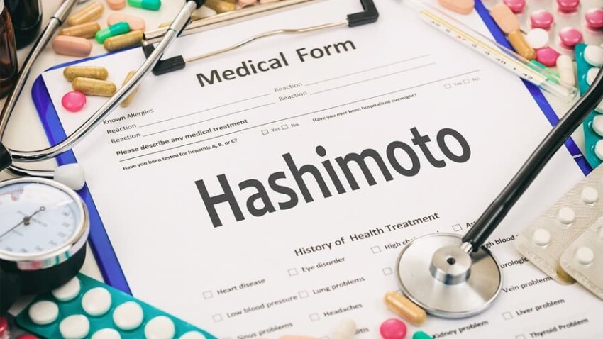 Soia e sindrome di hashimoto