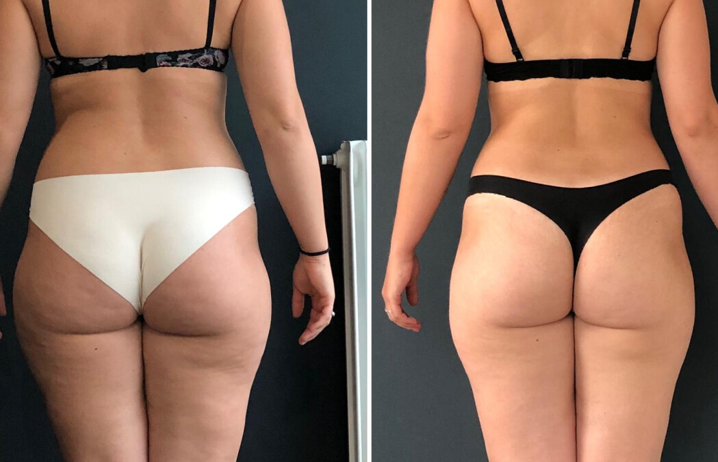 Scheda glutei ironmanager