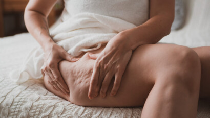 Rimedi efficaci contro la cellulite