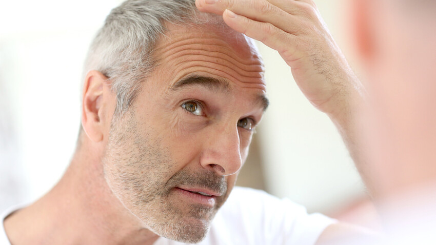 Senior man and hair loss issue
