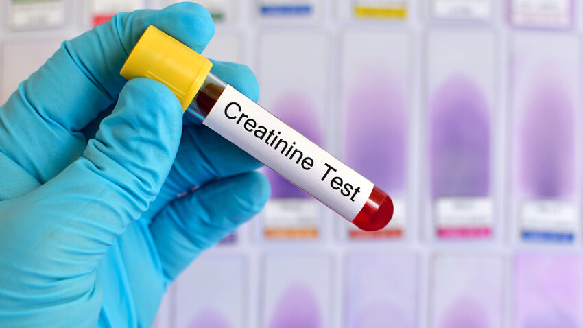 Test tube with blood sample for creatinine test, renal disease diagnosis